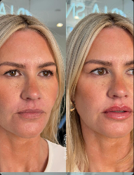 641761303_18129433894535312_1612009390814121894_n (1)