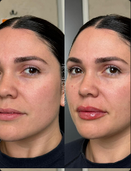 642795130_18130240240535312_434426997933351219_n