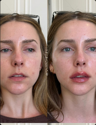 651919270_18131009404535312_4647521776338103008_n