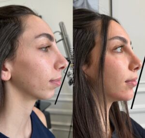 8781D4C9-9DF1-4863-97FC-D85715B71B7E