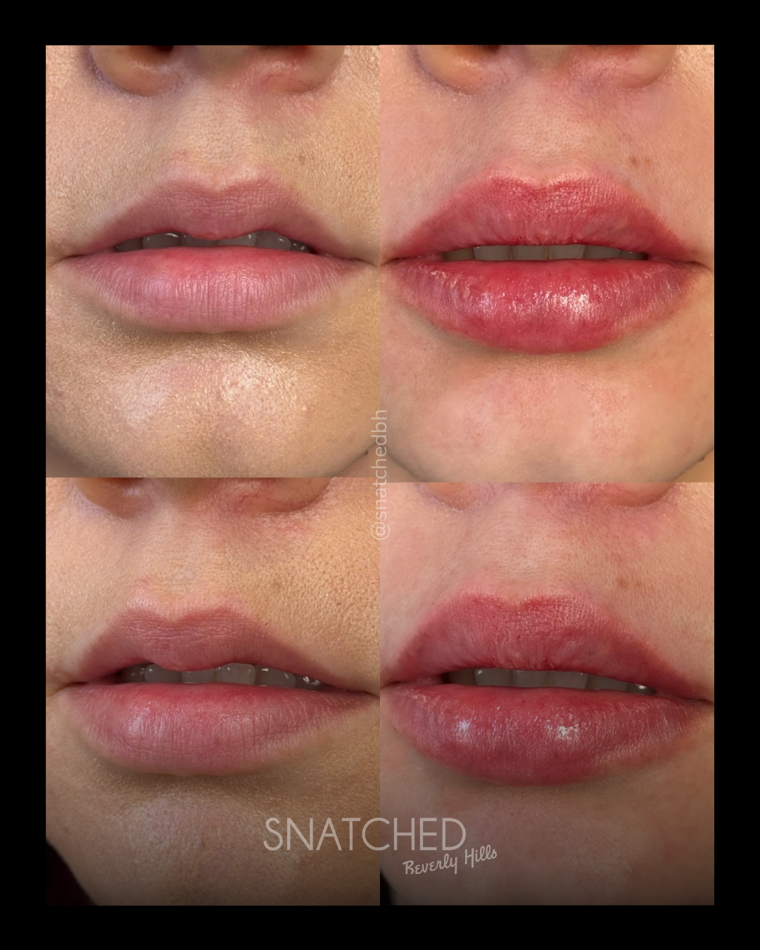 Lips from london 2