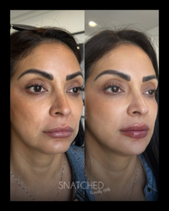 SNATCHED-FACIAL-BALANCING