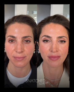 SNATCHED-FACIAL-BALANCING-PT2A