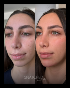 SNATCHED-FACIAL-BALANCING-PT4A