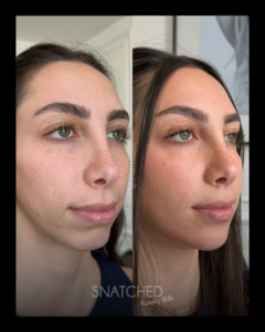 SNATCHED-FACIAL-BALANCING-PT4B