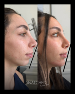 SNATCHED-FACIAL-BALANCING-PT4C