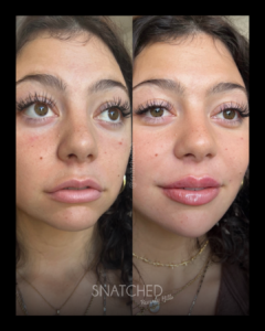 SNATCHED-FACIAL-BALANCING-PT6