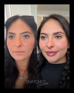SNATCHED-FACIAL-BALANCING-PT7