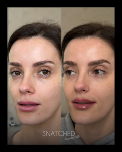 SNATCHED-FACIAL-BALANCING-PT8A