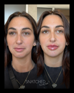 SNATCHED-FACIAL-BALANCING-PT9