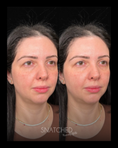 SNATCHED-REGIMEN-PT1