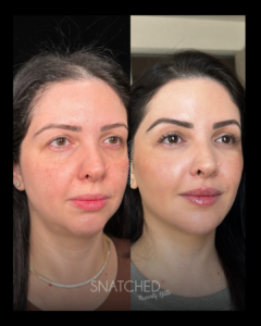 SNATCHED-REGIMEN-PT2