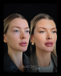 SNATCHED-REGIMEN-PT2