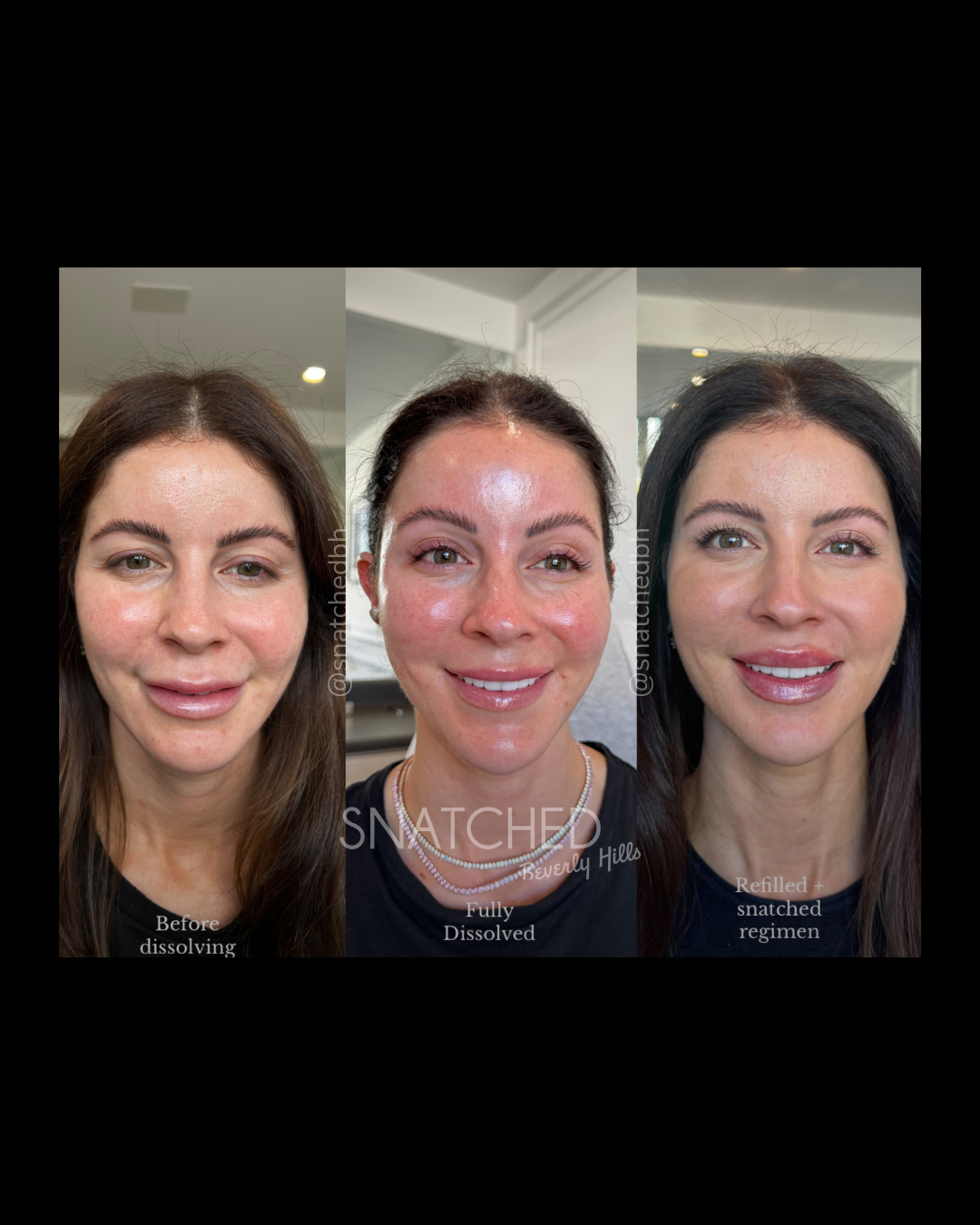 Before and after result 5