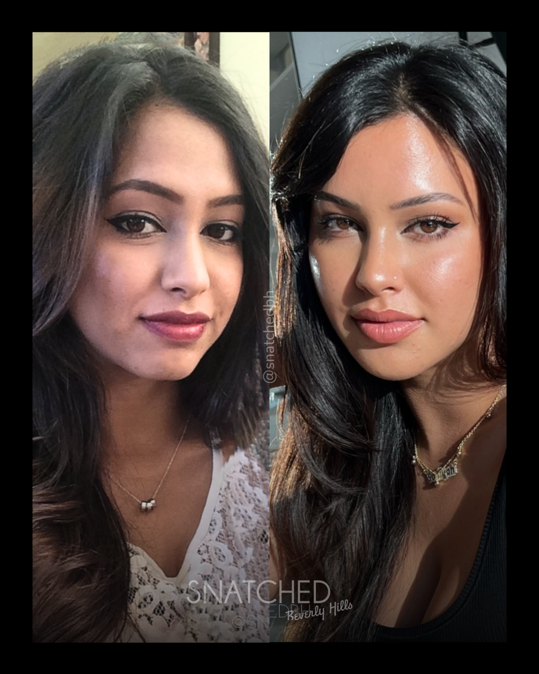 Before and after result 1