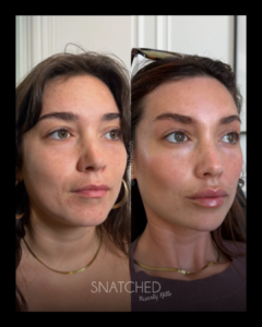 SNATCHED-REGIMEN-PT5