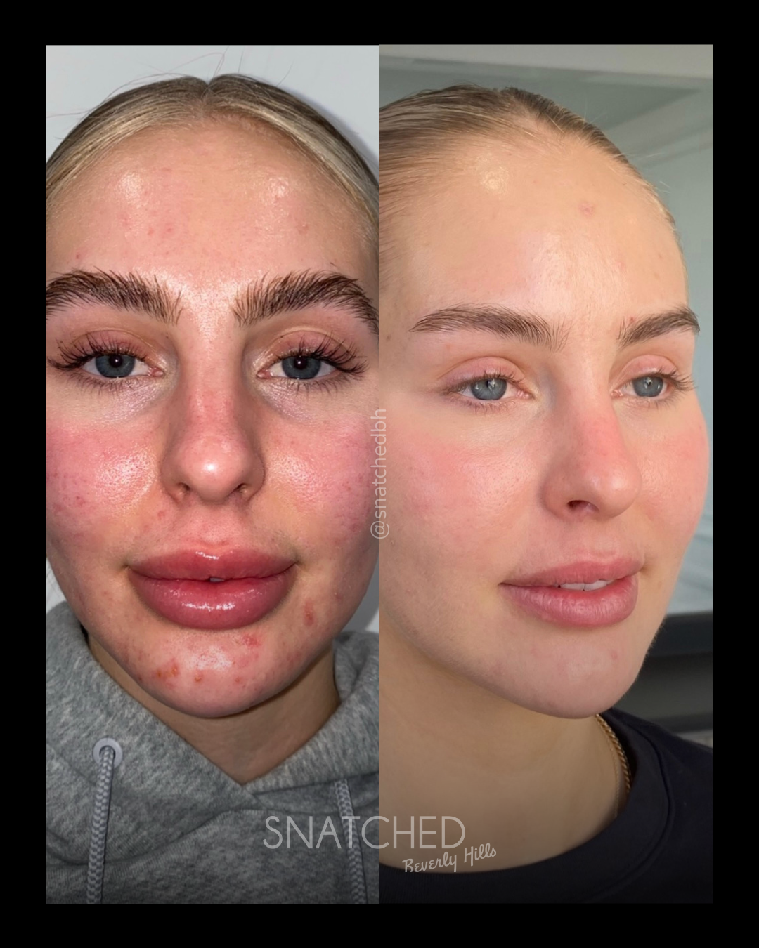 Before and after result 3
