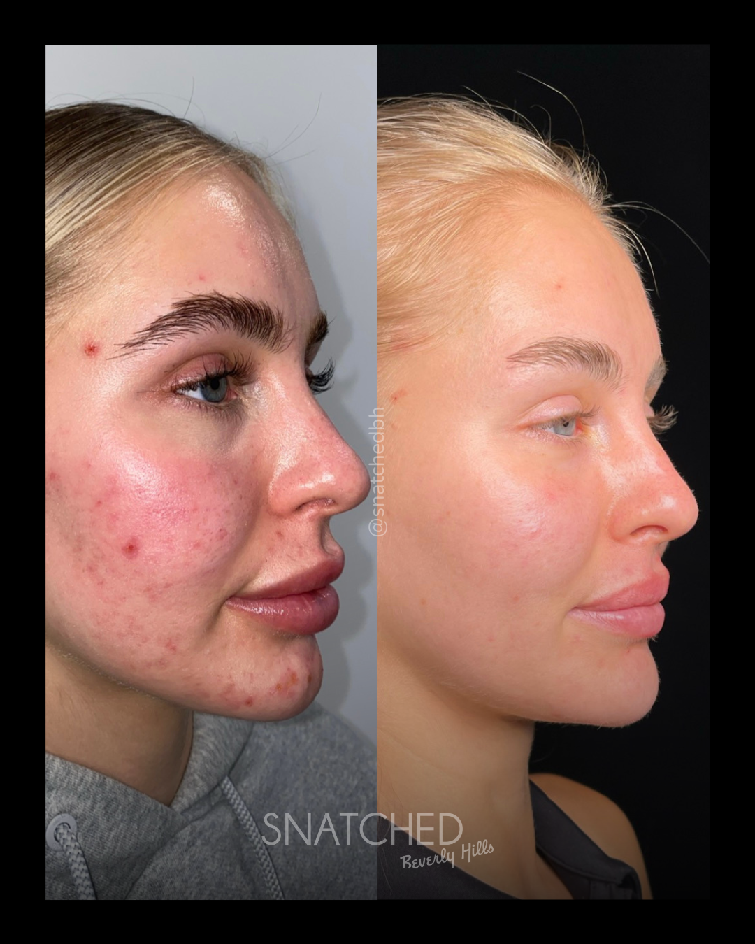 Before and after result 4