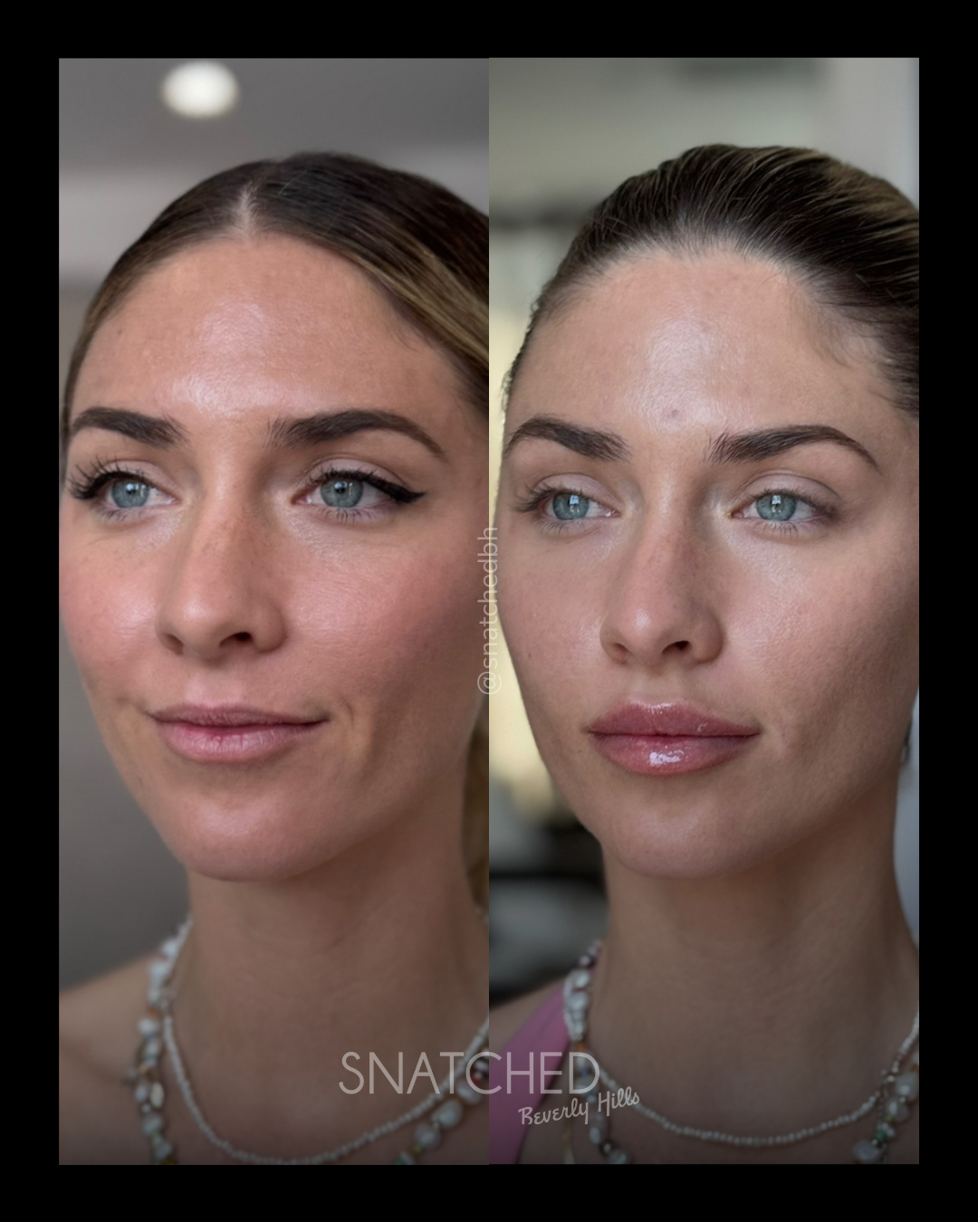 Before and after result 6