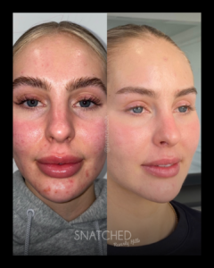 SNATCHED-REGIMEN-PT6A