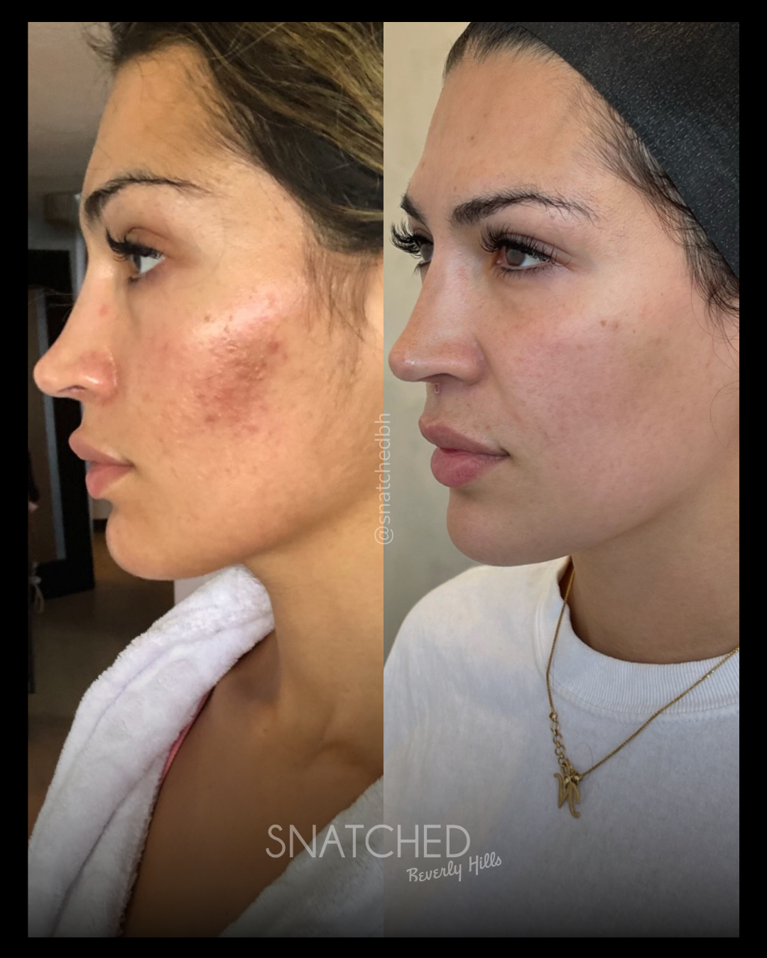 Before and after result 1