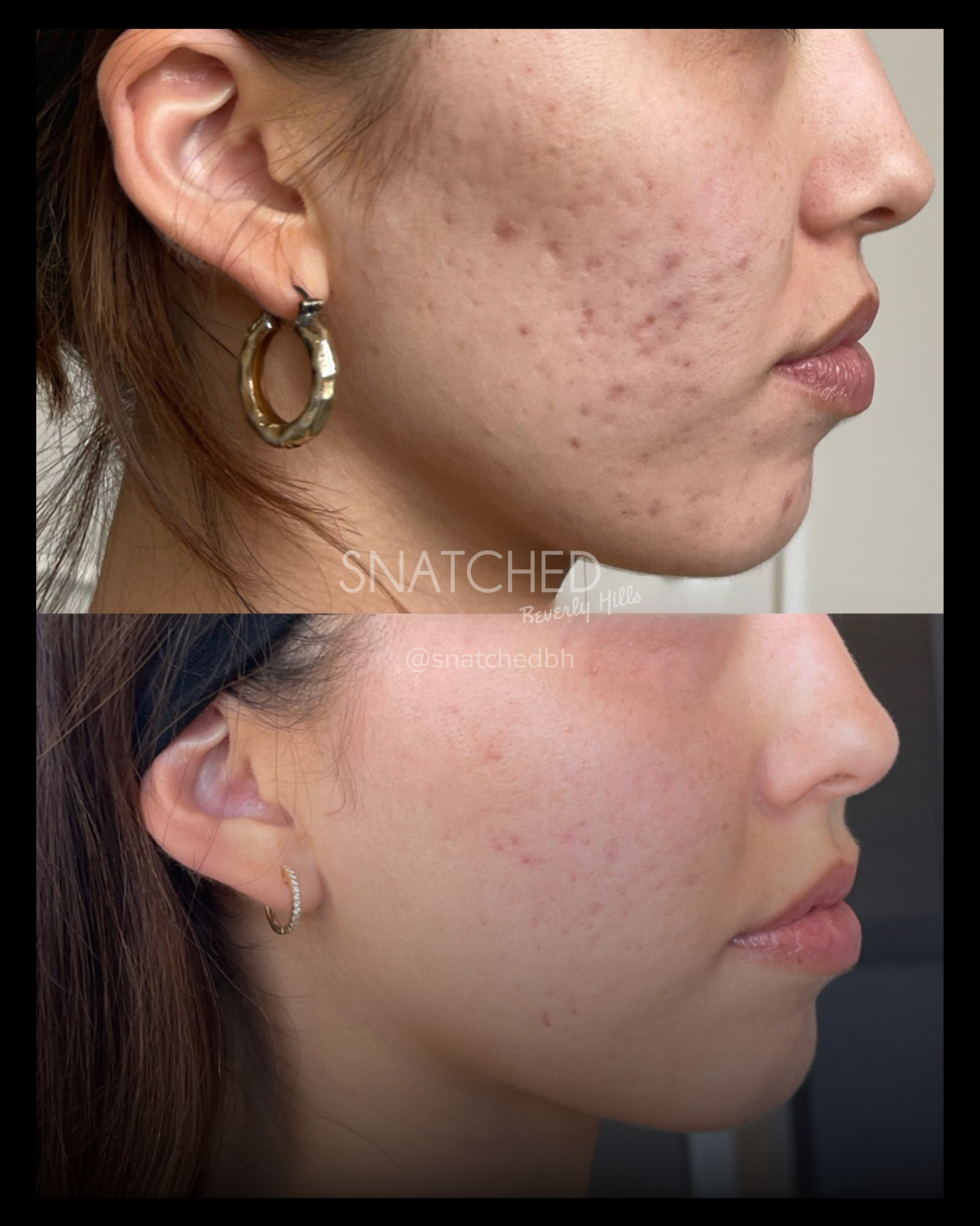 Before and after result 2