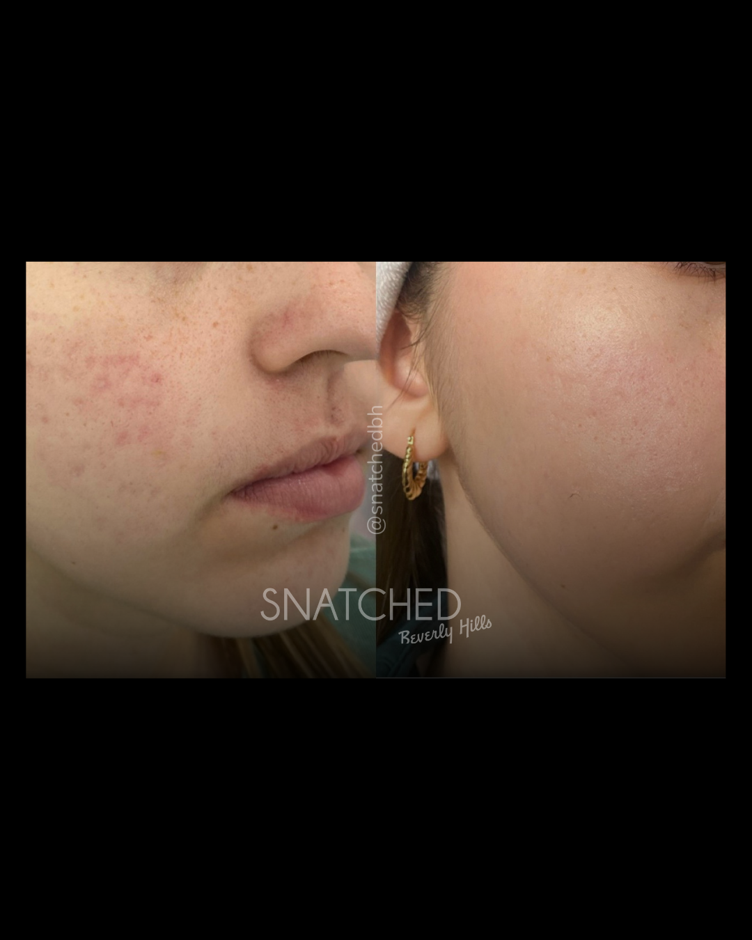 Before and after result 3