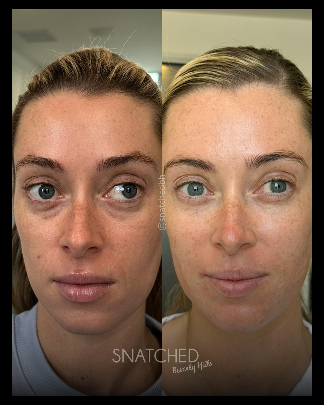 Before and after result 1
