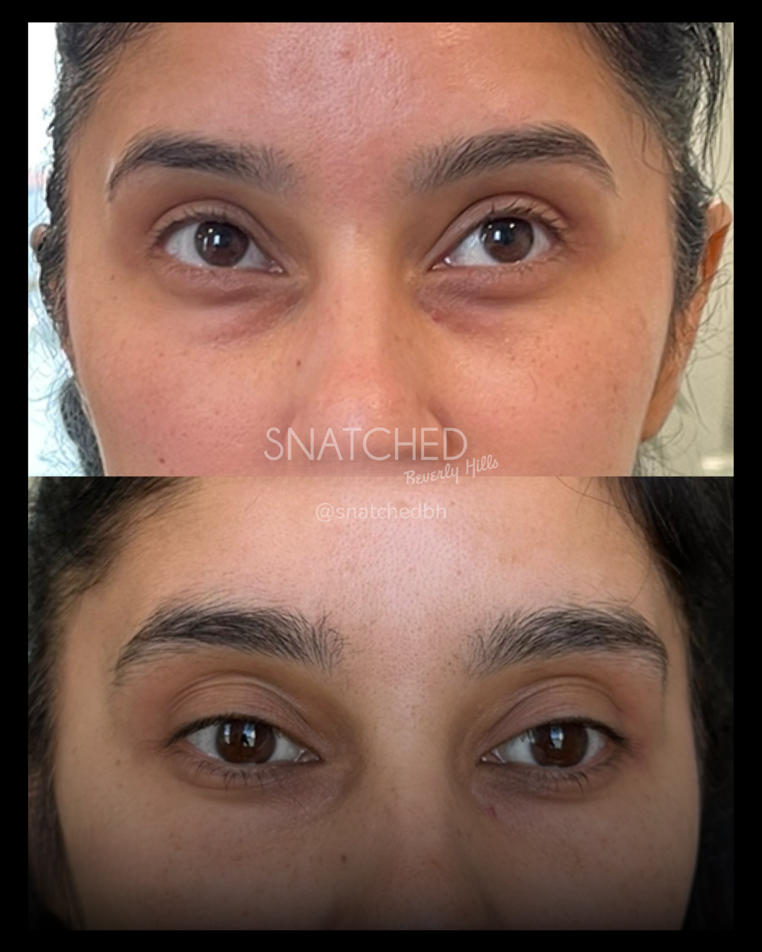 Before and after result 3