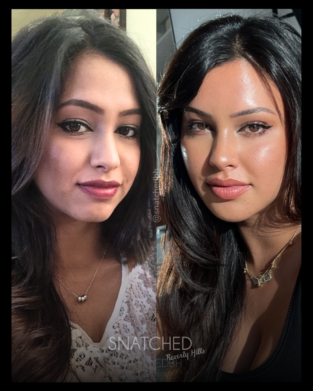 Before and after result 1
