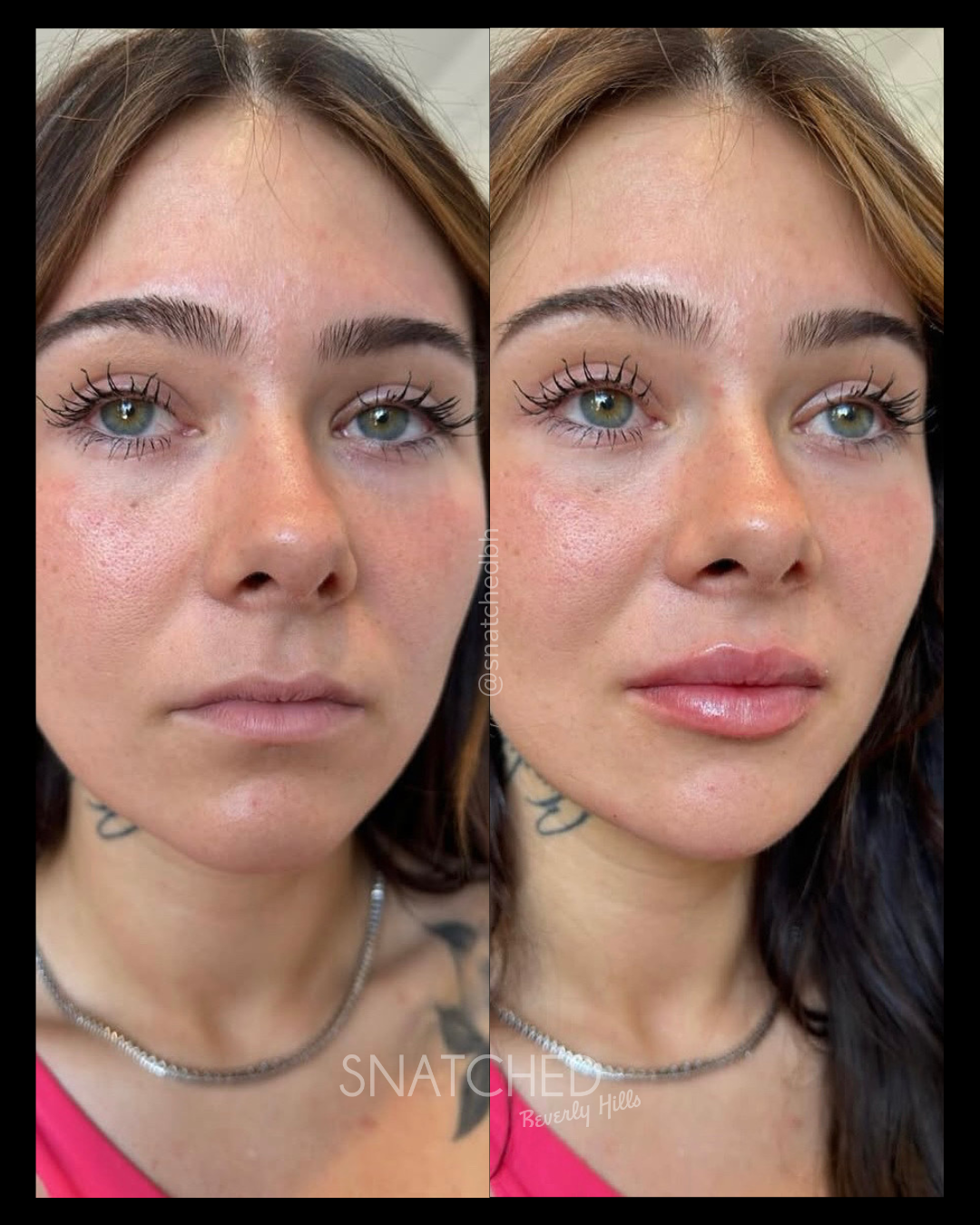 Before and after result 10