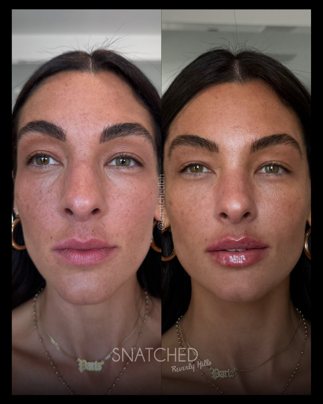 Before and after result 2