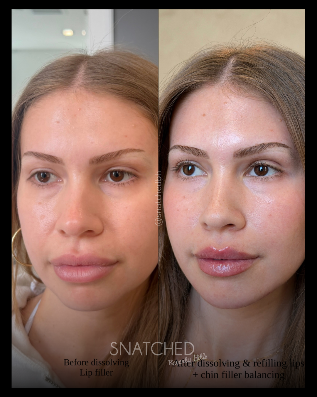 Before and after result 5