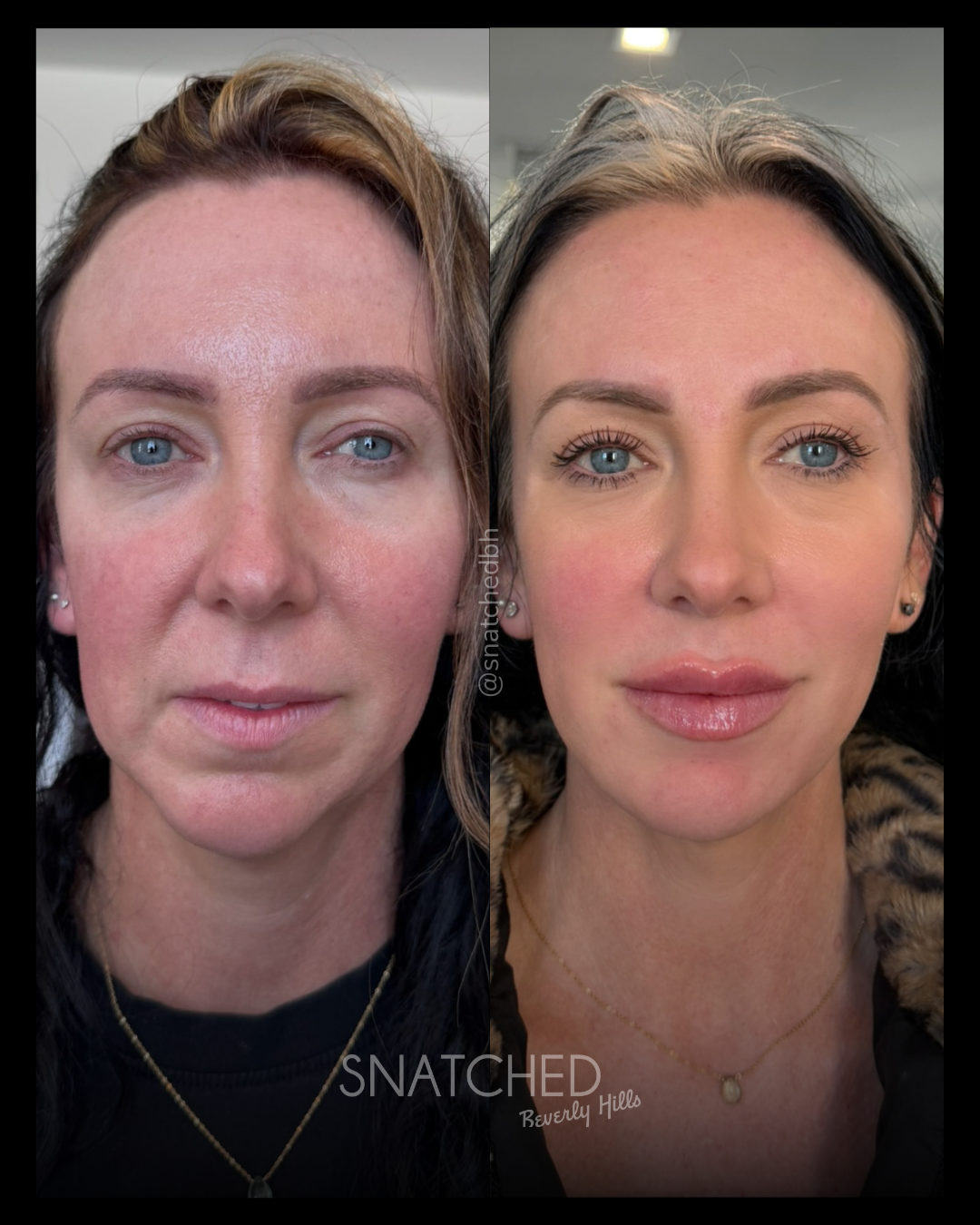Before and after result 6