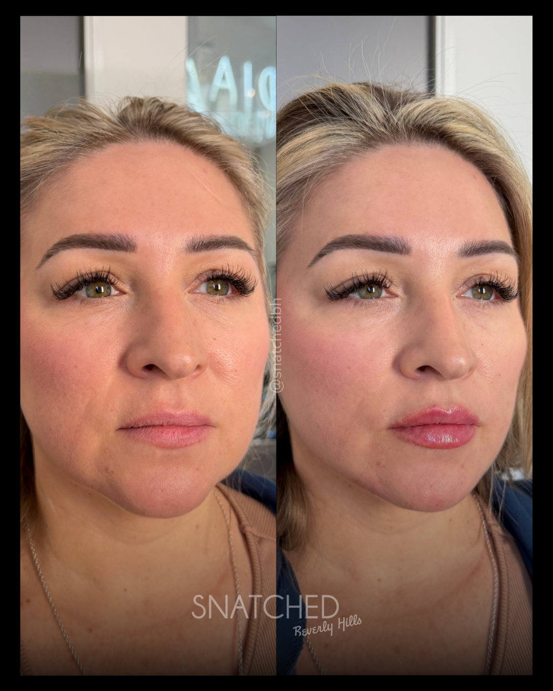 Before and after result 9