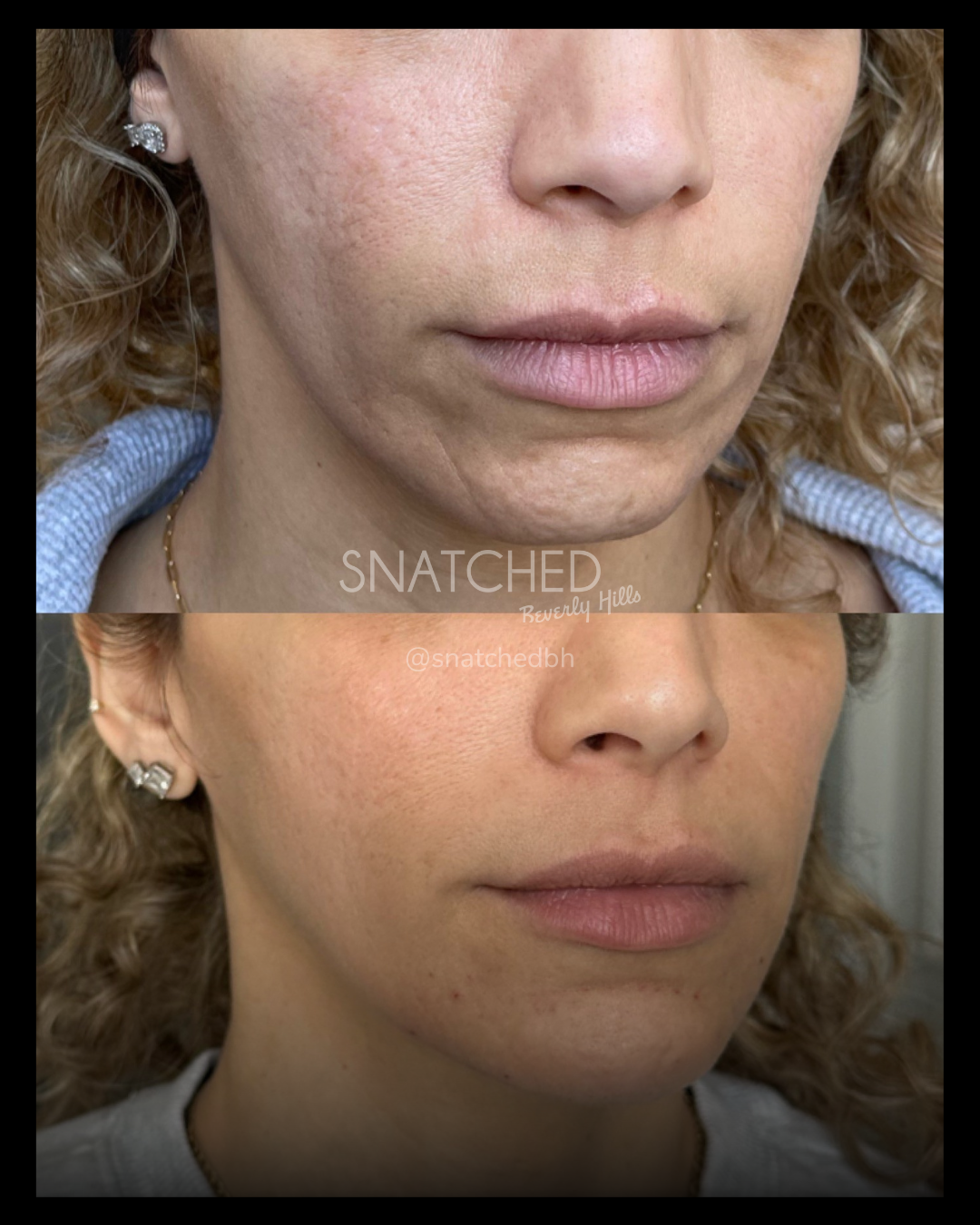 Before and after result 8