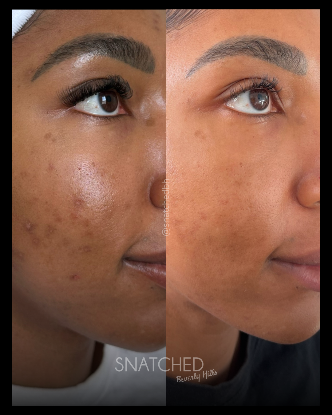 Before and after result 3