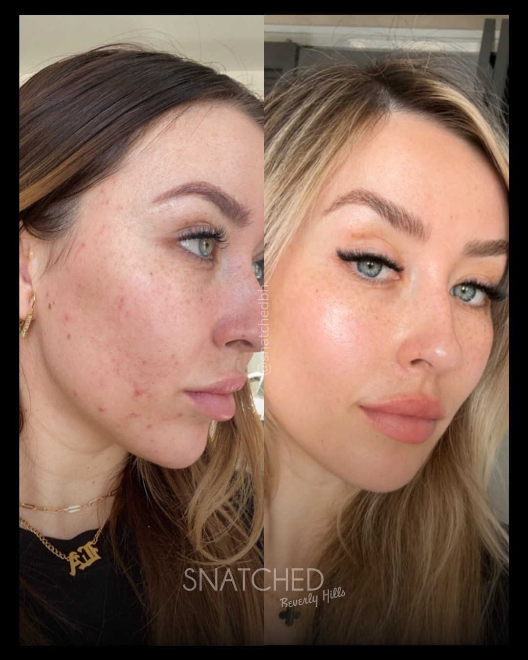 Before and after result 1