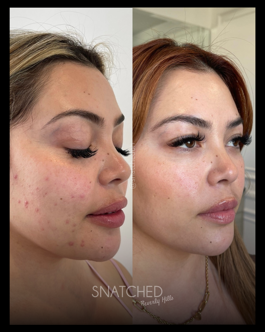 Before and after result 4