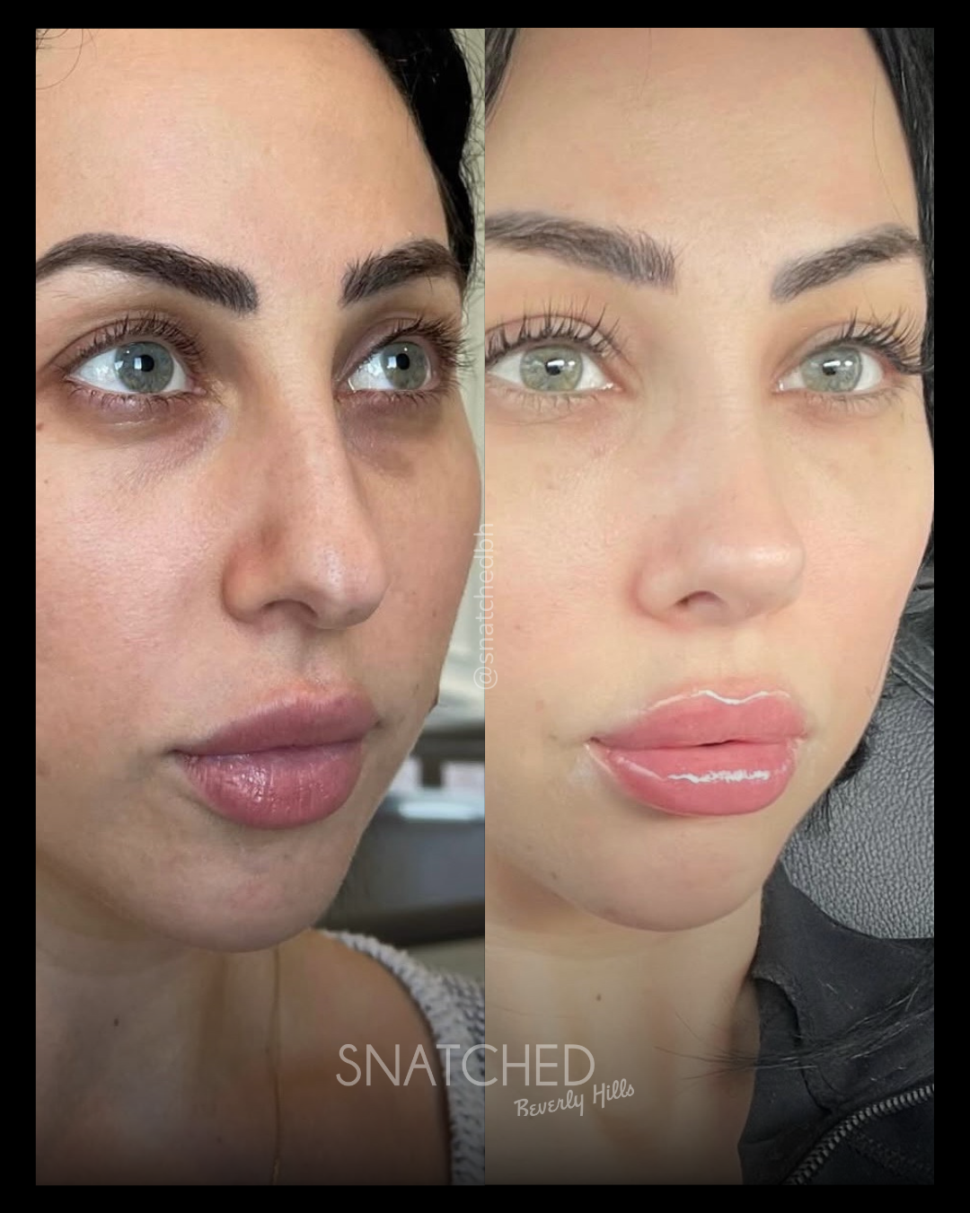 Before and after result 5