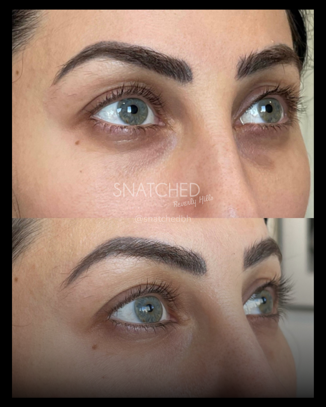 Before and after result 4