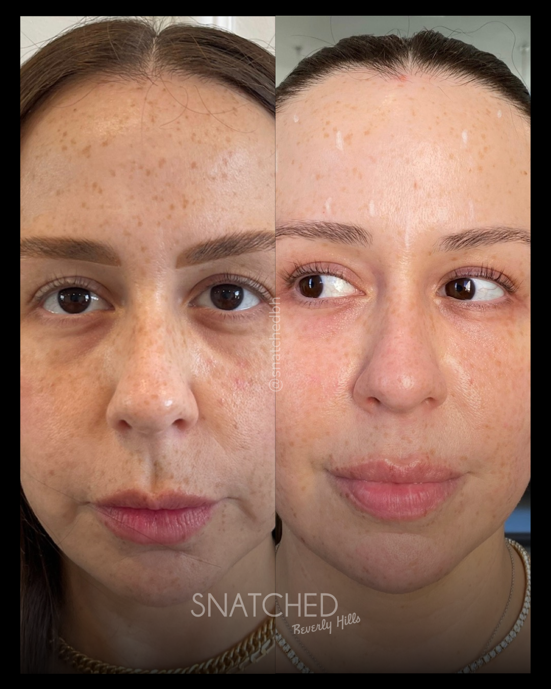 Before and after result 1