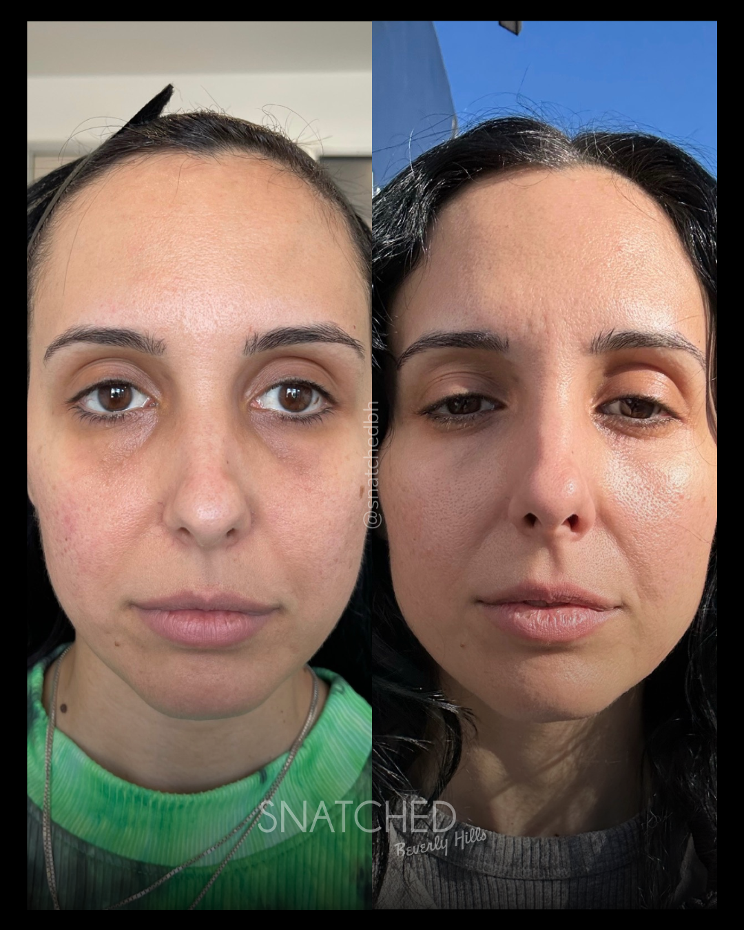 Before and after result 2