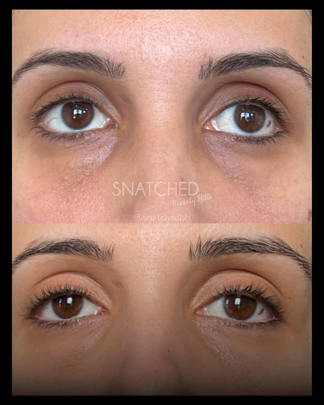 Before and after result 3