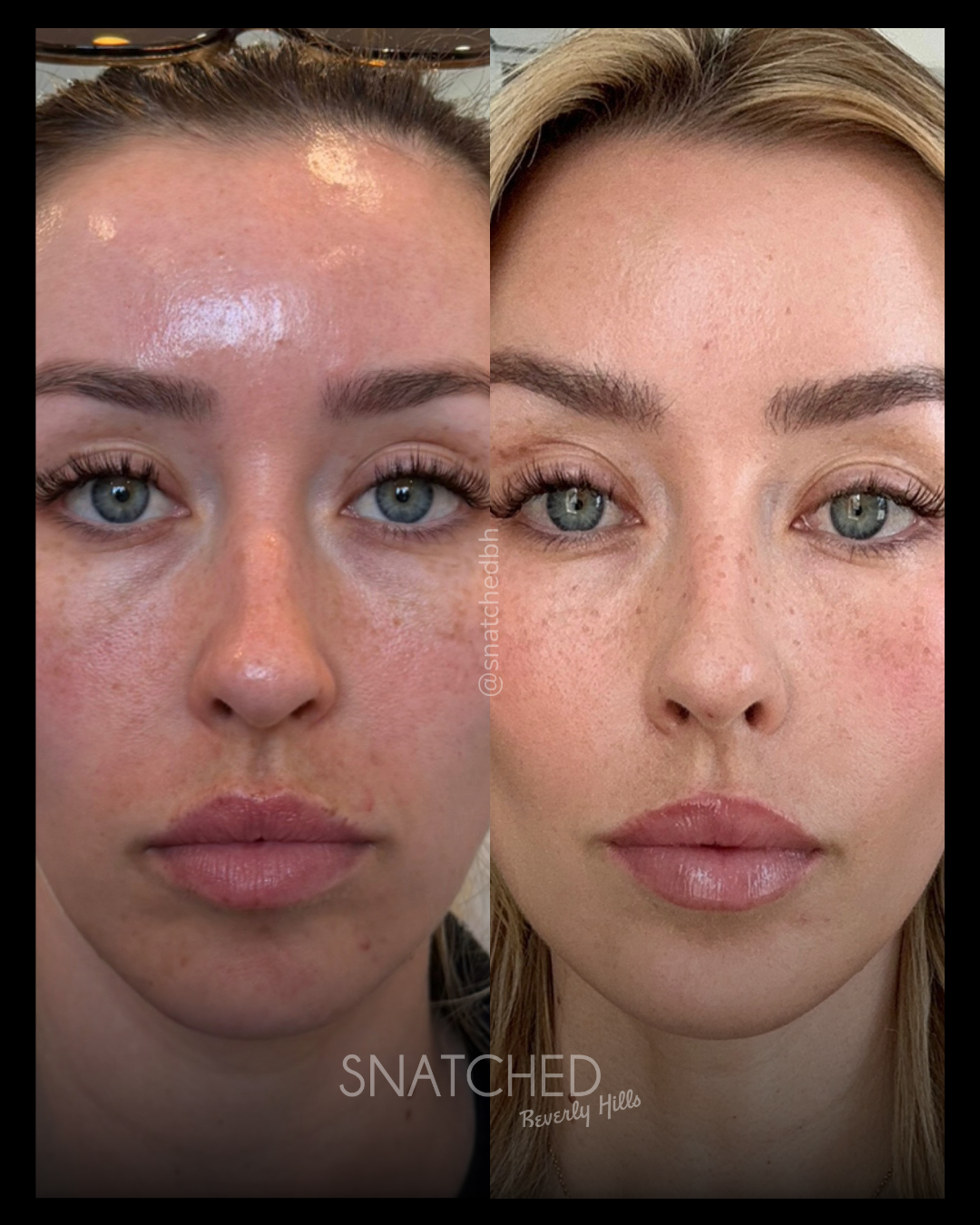 Before and after result 1
