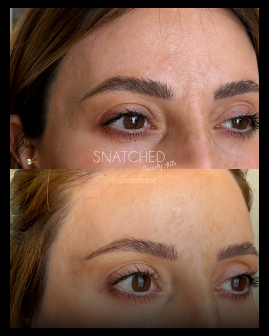 Before and after result 3