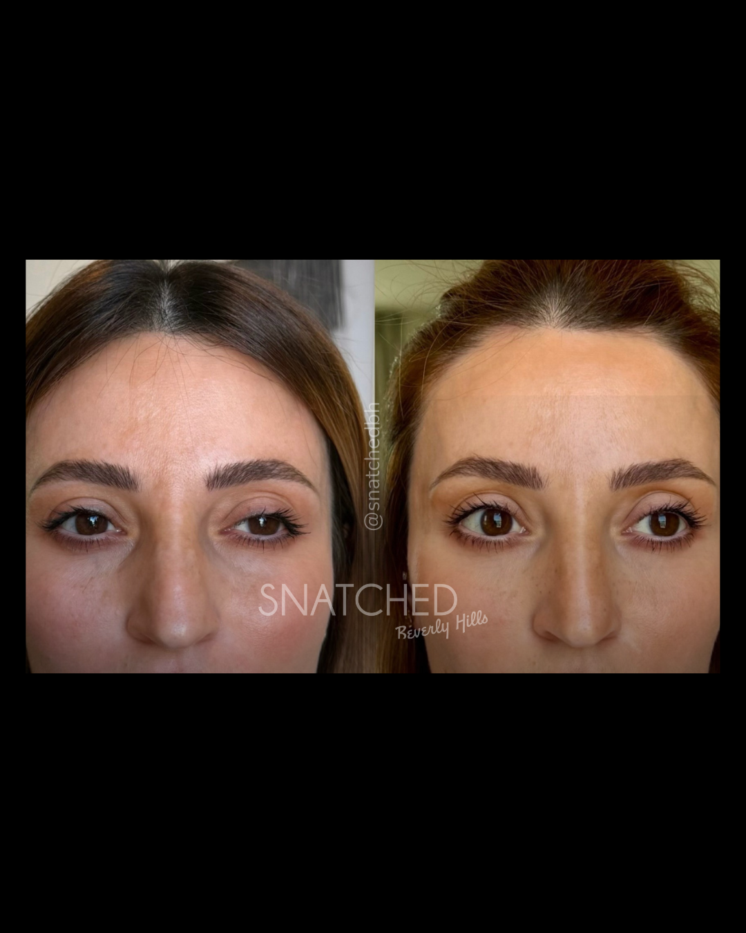 Before and after result 5