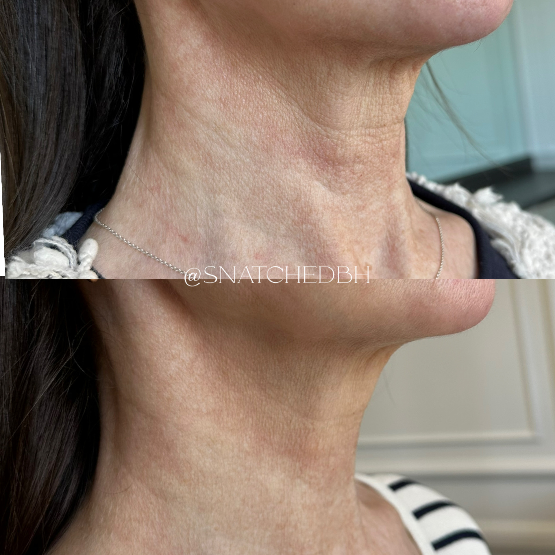 Before and after result 7