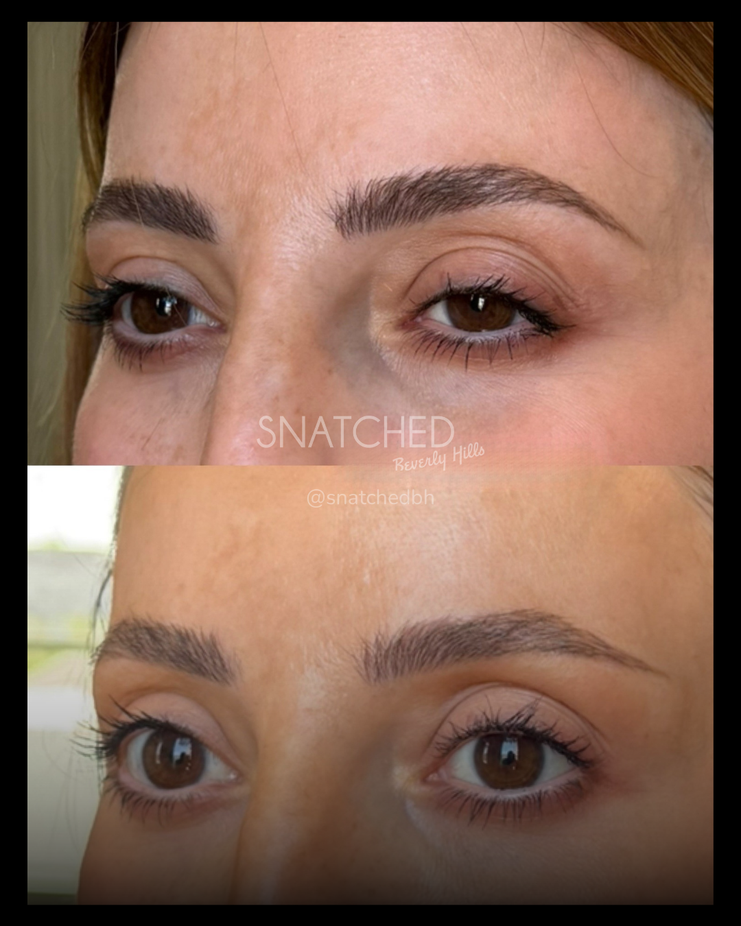 Before and after result 4