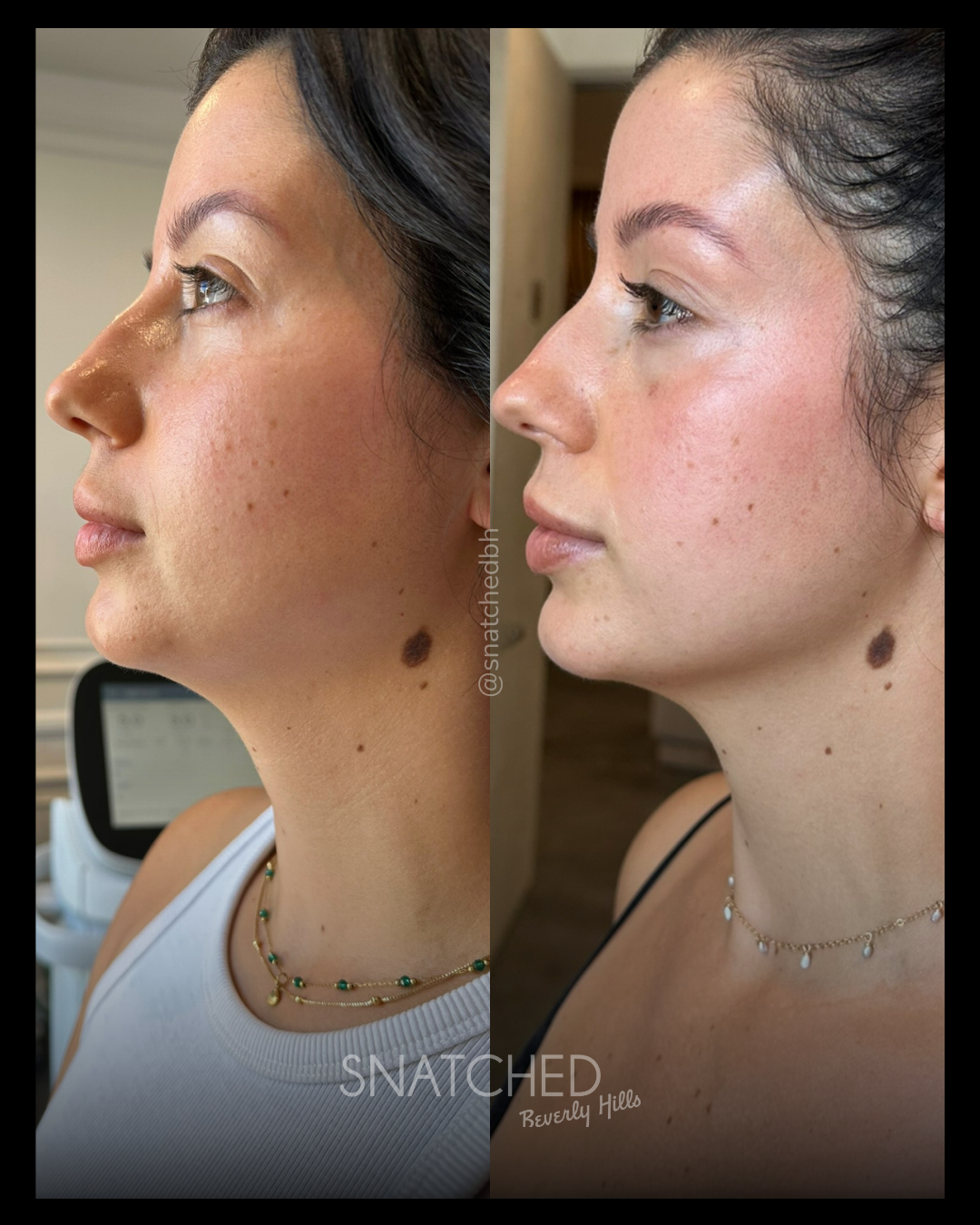 Before and after result 7